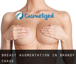 Breast Augmentation in Brandy Chase