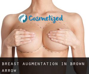 Breast Augmentation in Brown Arrow