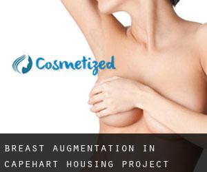 Breast Augmentation in Capehart Housing Project