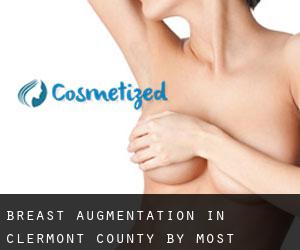Breast Augmentation in Clermont County by most populated area - page 3