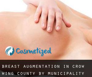 Breast Augmentation in Crow Wing County by municipality - page 1