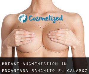 Breast Augmentation in Encantada-Ranchito-El Calaboz
