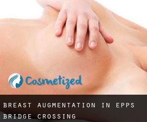 Breast Augmentation in Epps Bridge Crossing