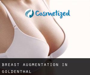 Breast Augmentation in Goldenthal