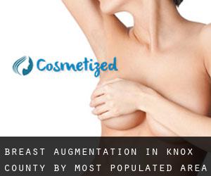 Breast Augmentation in Knox County by most populated area - page 4