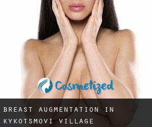 Breast Augmentation in Kykotsmovi Village