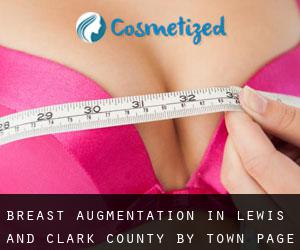 Breast Augmentation in Lewis and Clark County by town - page 1