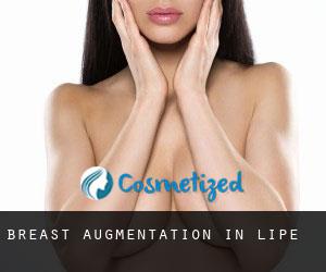 Breast Augmentation in Lipe