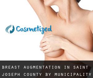 Breast Augmentation in Saint Joseph County by municipality - page 1