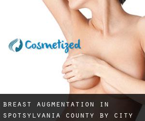Breast Augmentation in Spotsylvania County by city - page 1