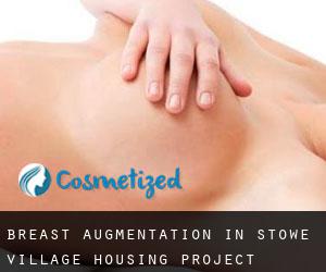 Breast Augmentation in Stowe Village Housing Project