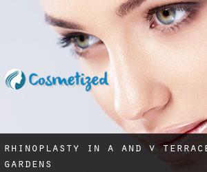 Rhinoplasty in A and V Terrace Gardens