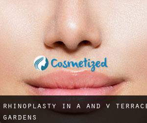 Rhinoplasty in A and V Terrace Gardens