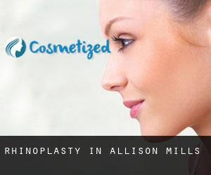 Rhinoplasty in Allison Mills