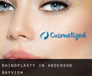 Rhinoplasty in Anderson Bayview