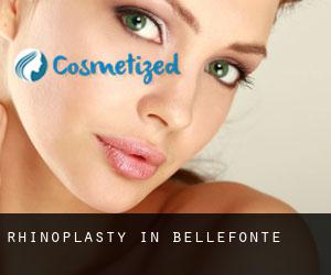 Rhinoplasty in Bellefonte