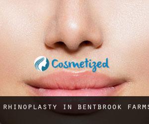 Rhinoplasty in Bentbrook Farms