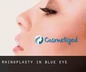 Rhinoplasty in Blue Eye