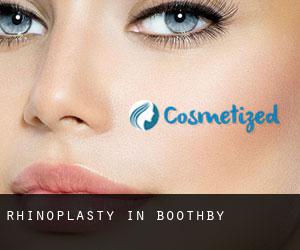 Rhinoplasty in Boothby