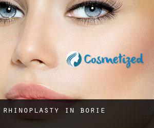 Rhinoplasty in Borie