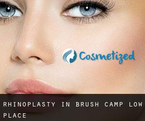 Rhinoplasty in Brush Camp Low Place