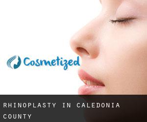 Rhinoplasty in Caledonia County Rhinoplasty in Caledonia County
