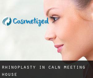 Rhinoplasty in Caln Meeting House