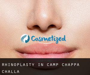 Rhinoplasty in Camp Chappa Challa