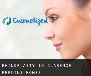 Rhinoplasty in Clarence Perkins Homes