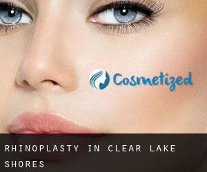 Rhinoplasty in Clear Lake Shores