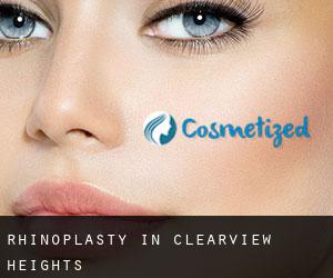 Rhinoplasty in Clearview Heights