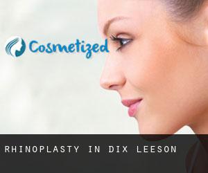 Rhinoplasty in Dix-Leeson