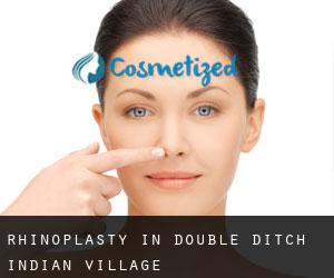 Rhinoplasty in Double Ditch Indian Village