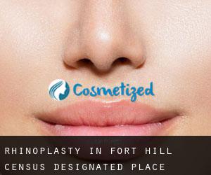 Rhinoplasty in Fort Hill Census Designated Place
