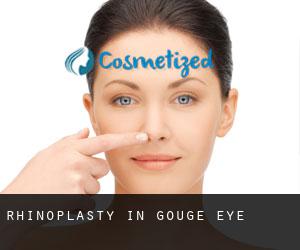 Rhinoplasty in Gouge Eye