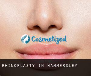 Rhinoplasty in Hammersley