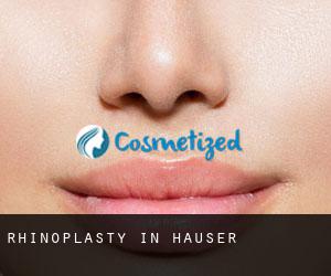 Rhinoplasty in Hauser