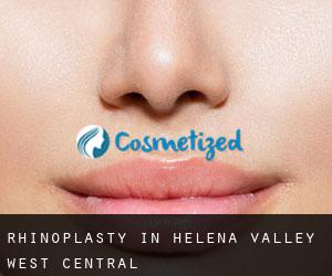 Rhinoplasty in Helena Valley West Central