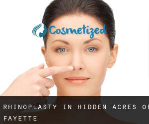 Rhinoplasty in Hidden Acres of Fayette