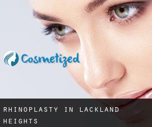 Rhinoplasty in Lackland Heights