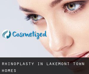 Rhinoplasty in Lakemont Town Homes