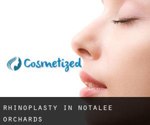 Rhinoplasty in Notalee Orchards