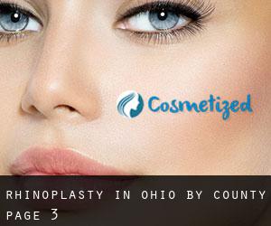 Rhinoplasty in Ohio by County - page 3