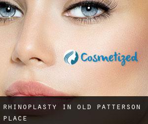 Rhinoplasty in Old Patterson Place