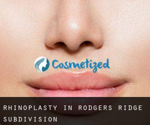 Rhinoplasty in Rodgers Ridge Subdivision