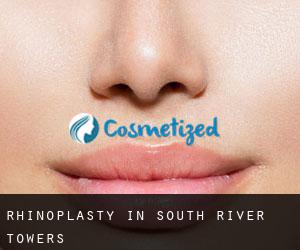Rhinoplasty in South River Towers