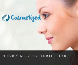 Rhinoplasty in Turtle Lake