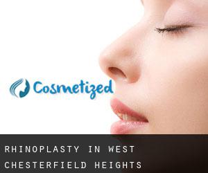 Rhinoplasty in West Chesterfield Heights