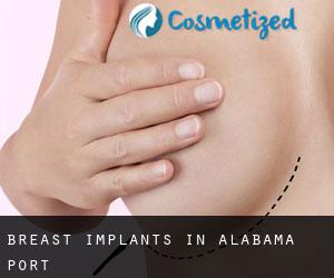 Breast Implants in Alabama Port