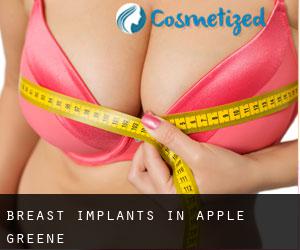 Breast Implants in Apple Greene